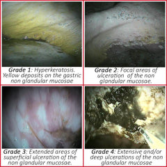 STOMACH-PROTEK SPEED ACTION - 6 قطع / PK-KB